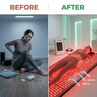 Red Light Therapy Mat for Full Body, 76.8'' X 33.4'' Red Light Therapy Blanket, 1370 (660Nm & 850Nm) Leds for Home Use, 3 Modes & Adjustable Timer, Premium Leather — Before & After
